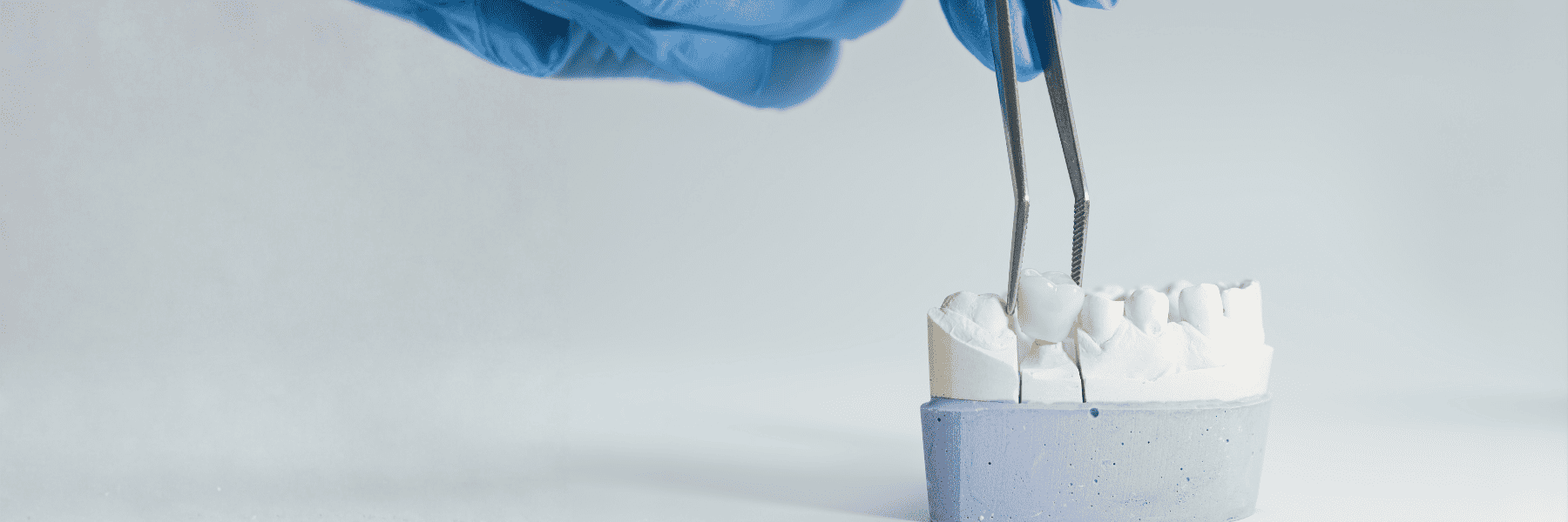 Dental Crowns and Bridges | Dentist